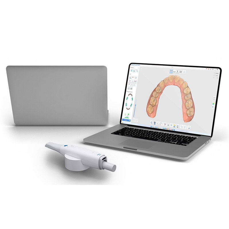 Escáner intraoral Medit i700 wireless 2 Digital dental impression scanner y laptop con diseño 3D de arco dental, equipo avanzado para clínicas dentales.