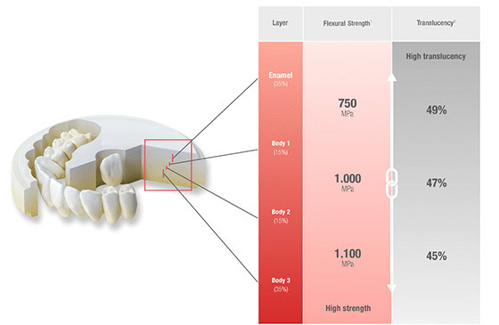 Paleta de colores con gráficos de fuerza y translucencia en materiales dentales, mostrando diferentes capas y su resistencia. Foco en enmascaramiento, durabilidad y calidad en suministros dentales.