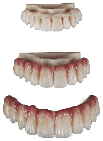Moldes de dentadura en diferentes etapas de creación y ajuste, ideales para clínicas dentales y laboratorios especializados en prótesis.