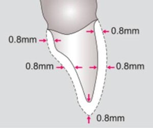 Herramientas y suministros dentales de alta calidad ofrecidos por Binario Digital para profesionales de la odontología.
