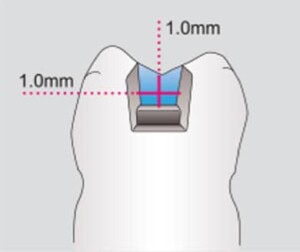 Alta calidad en suministros dentales, equipo profesional y materiales especializados para clínicas odontológicas y laboratorios en Costa Rica.