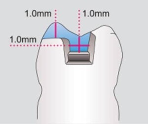 Alta calidad de suministros dentales y equipo especializado de Binario Digital, diseñado para profesionales en odontología que buscan precisión y calidad en sus procedimientos.