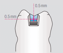 Cabezales de reparación de restauraciones dentales con precisión de 0.5 mm para odontología avanzada, mostrando detalles en instrumentación dental.