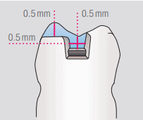 Una representación gráfica de un componente dental con mediciones precisas en milímetros.