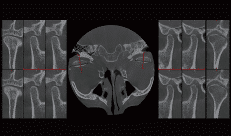 Sistema de imagenología dental, radiografías de dientes y maxilares, mostrando detalles de estructuras óseas y dentales para diagnósticos precisos. Equipo profesional para odontología de alta calidad.