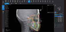 Equipo de radiografía dental con tecnología avanzada para análisis preciso de salud bucal.