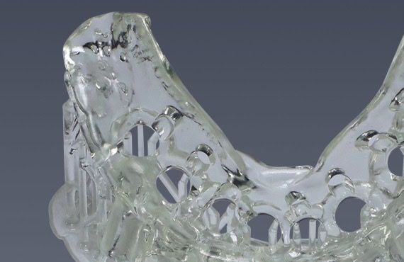 Cargador de prótesis dentales de acrílico transparente, utilizado para la fabricación y ajuste de prótesis en clínicas dentales.