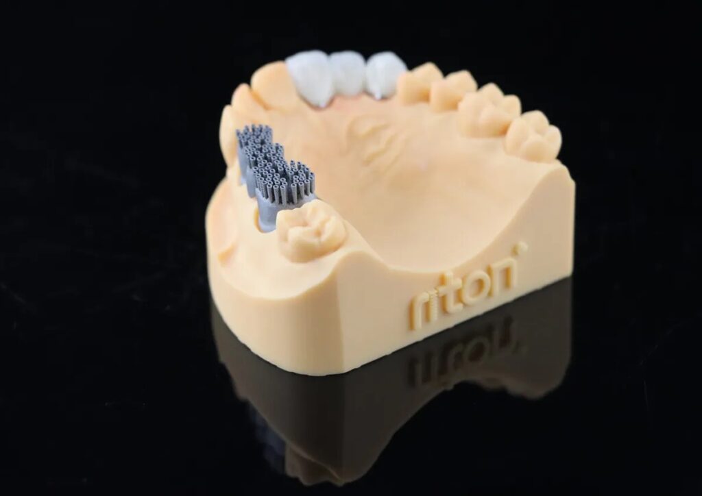 Protesis dental en modelo de estudio con implantes y coronas, utilizada para planificación y demostración en odontología.