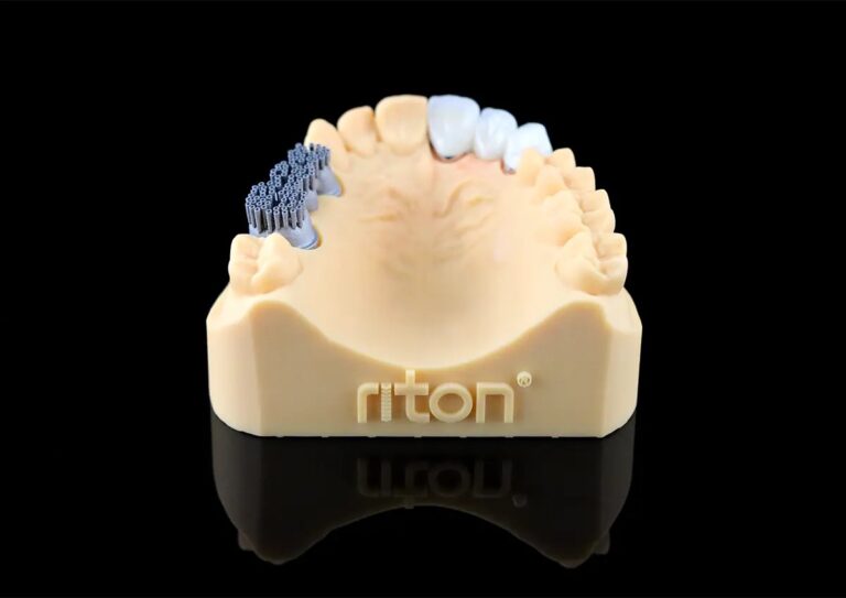 Impresora 3D de metal M-150 19 Modelo de prótesis dental con componentes metálicos y cerámicos, utilizado para planificación y fabricación de restauraciones dentales precisas.