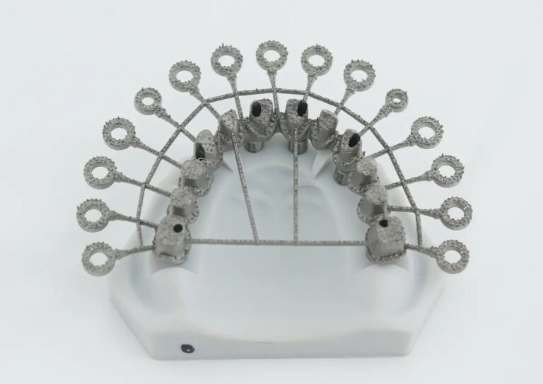 Impresora 3D de metal M-150 21 Conjunto de componentes metálicos para la colocación de implantes dentales, utilizados en procedimientos odontológicos para reemplazar dientes perdidos.