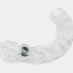 Sustrato dental de alta precisión para restauraciones y prótesis, fabricado con materiales de calidad para garantizar durabilidad y ajuste perfecto en tratamientos odontológicos.