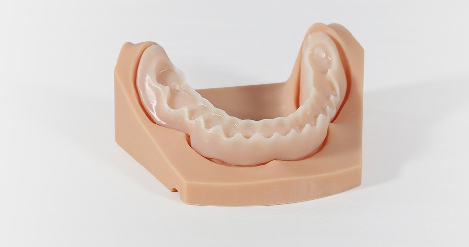 Impresora 3D de resina PioCreat D136 2 Prótesis dentales en modelo de encía, utilizada para la fabricación y ajuste de prótesis en tratamientos odontológicos.