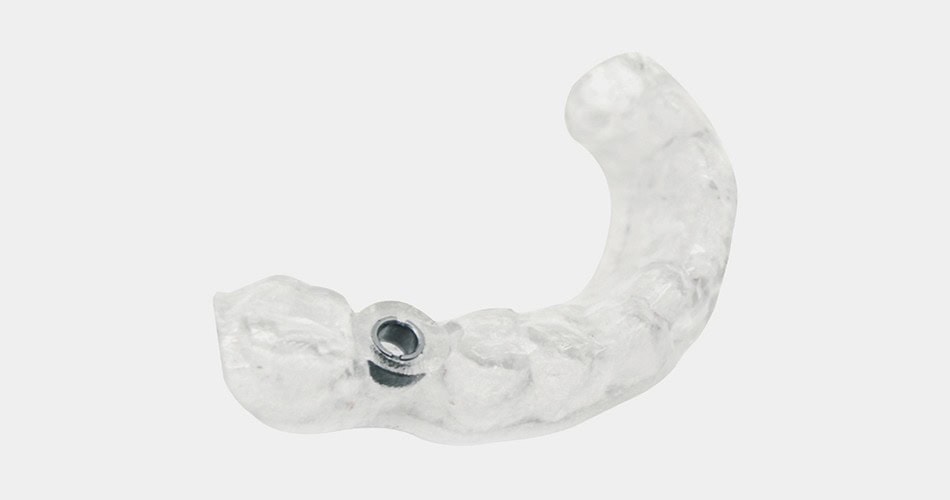 Impresora 3D de resina PioCreat D136 4 Muestra un equipo dental especializado en restauraciones, diseñado para ofrecer precisión y comodidad en procedimientos odontológicos.