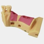 Implante dental anatómico en modelo de entrenamiento, utilizado en procedimientos odontológicos para simular la colocación de implantes en la mandíbula.