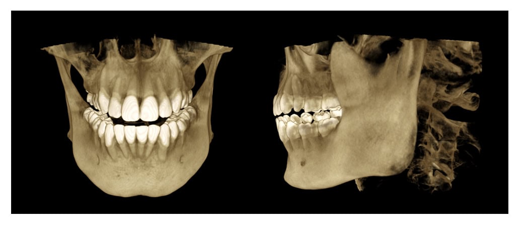 Ejemplo de alta resolución Smart3D-X