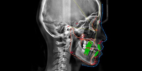 IA + Medición CEF (Opcional)