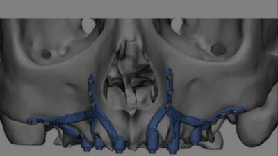 Imagen de equipo y suministros dentales de Binario Digital, incluyendo implantes y herramientas para odontología avanzada.