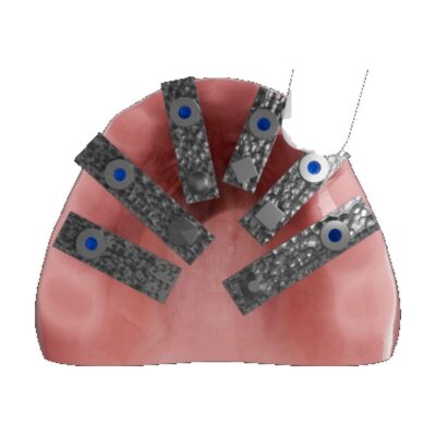 Imagen de componentes dentales con sensores y dispositivos de precisión para tratamientos odontológicos.