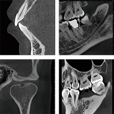 Imagen de radiografías dentales mostrando diversas estructuras óseas y dentales.