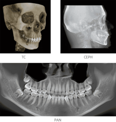 Hueso maxilar y mandibular con radiografías dental.