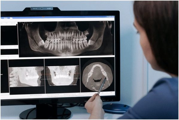 Archivo dental digital, radiografía panorámica y escáner intraoral en consulta odontológica. Equipo avanzado para diagnóstico preciso y tratamiento efectivo en clínicas dentales.