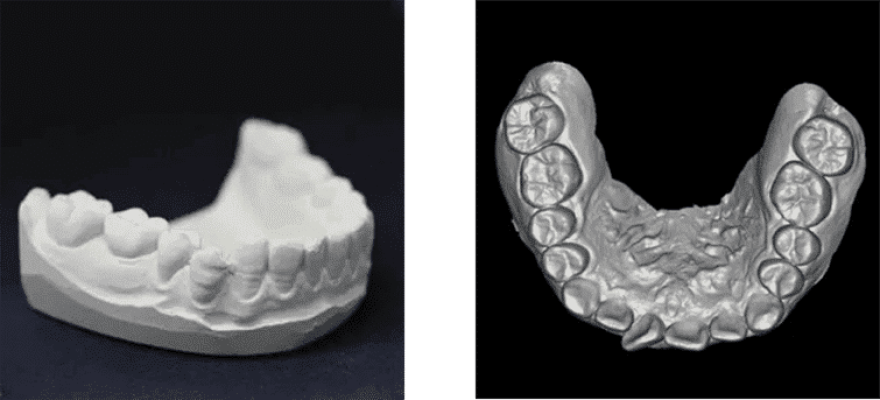 Modelos de prótesis dentales en yeso y acrílico para trabajos de laboratorio dental, mostrando precisión en reconstrucción dental y volumen de restauración.